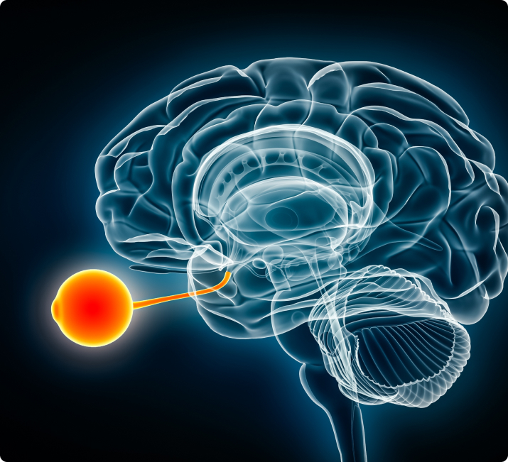 Cerebral Visual Impairment (CVI) Interventions