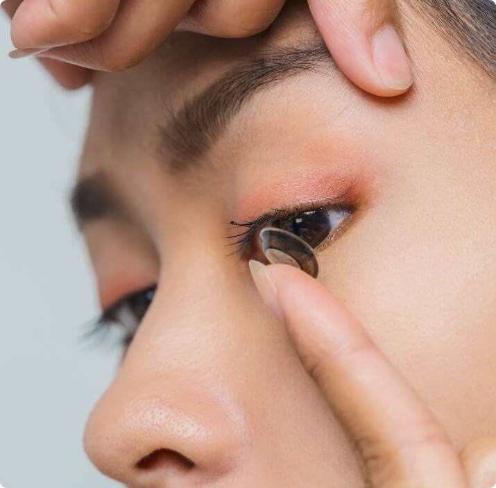 Implantable Contact Lenses (ICL)