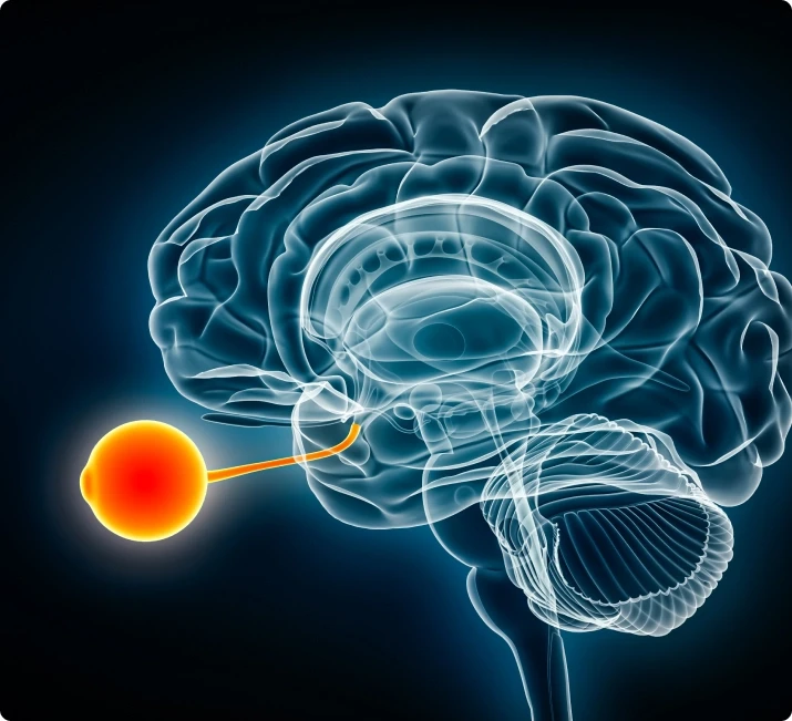 Cerebral Visual Impairment (CVI) Interventions