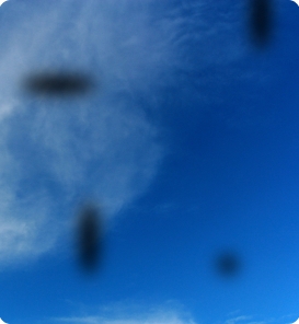 Eye Floaters and Flashes