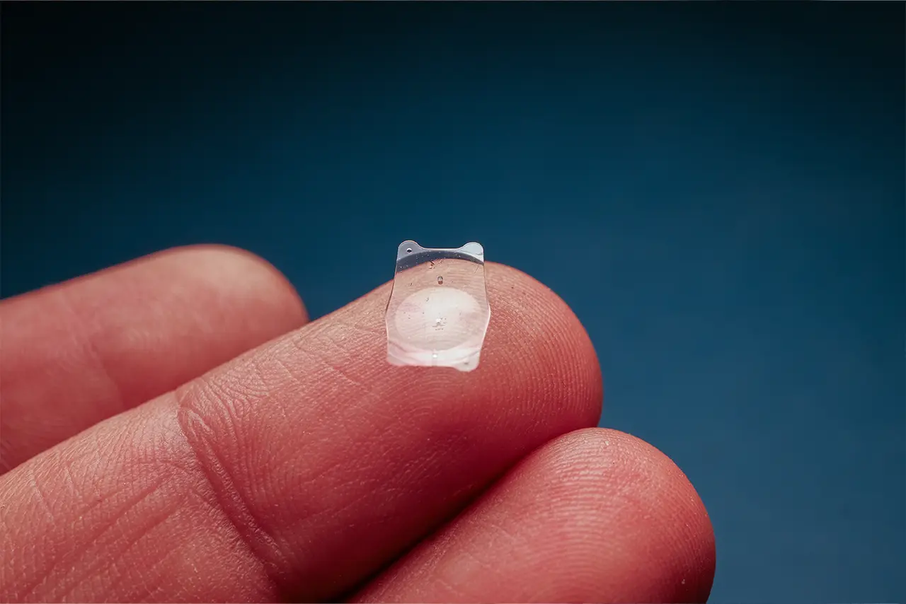 A tiny, transparent implantable contact lens (ICL) on a fingertip.